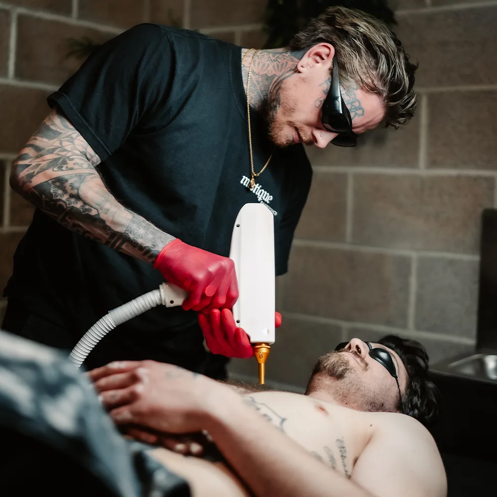 Professional Laser Tattoo Removal In Dorset.